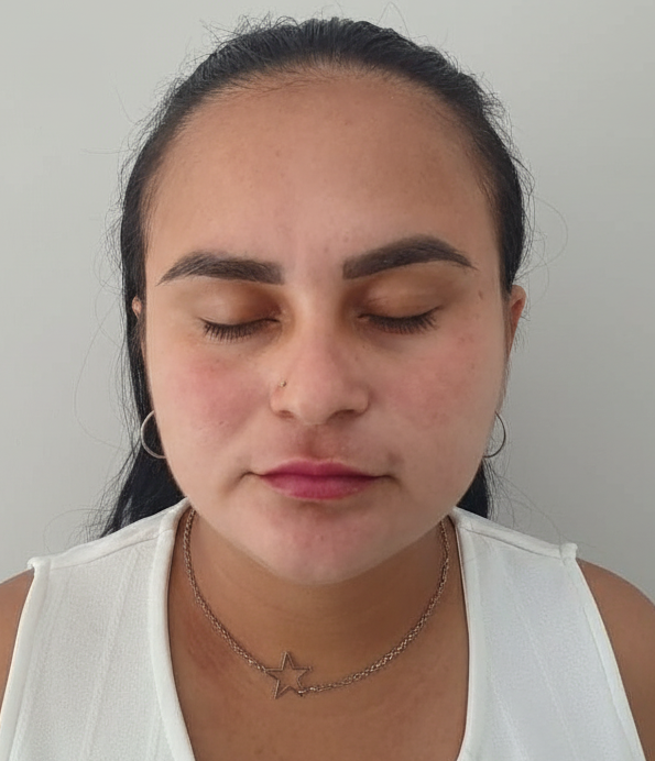 Depois - 45 dias de uso